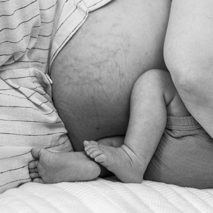 Vergetures et grossesse : tout ce que vous devez savoir